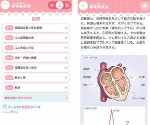 Appliv 循環器疾患 ナースフル疾患別シリーズ