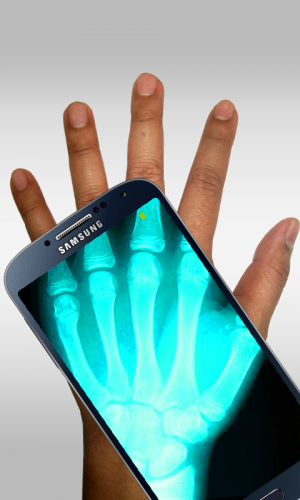 Appliv Xray Scanner Prank