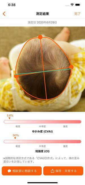 Appliv 赤ちゃんの頭のかたち測定