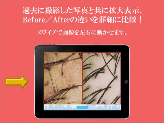 「TOWHEE - Scalp Camera App with Client Database」のスクリーンショット 2枚目