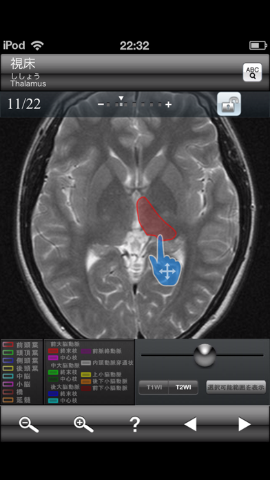 「断面図ウォーカー脳MRI」のスクリーンショット 1枚目