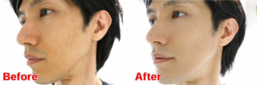 化粧のBeforeAfter
